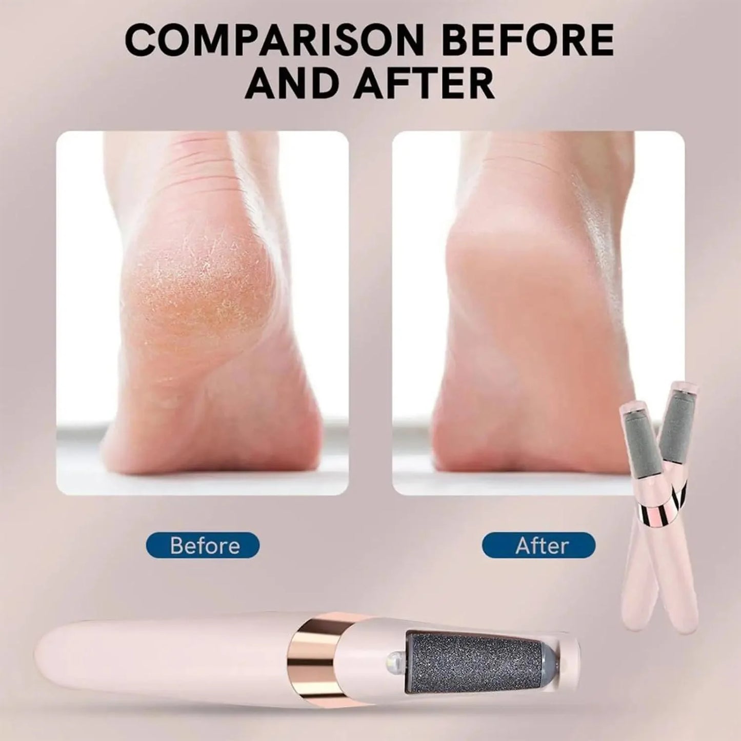 Pedicure Electronic Tool File Feet Callus Remover Hard Skin Remover Foot Care Tools