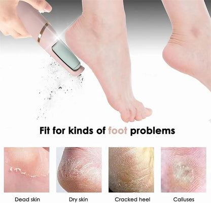 Pedicure Electronic Tool File Feet Callus Remover Hard Skin Remover Foot Care Tools